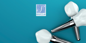 dental implants dentist on sinclair